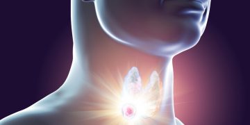 בעיות בבלוטת התריס  מהי בלוטת התריס? איפה היא ממוקמת ואילו בעיות בריאותיות עלולות להופיע בה? אורן זריף