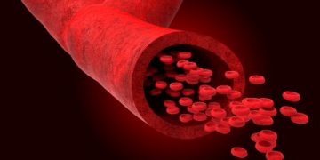 סובלים בעיות כלי דם אורן זריף פסיכוקינזיס