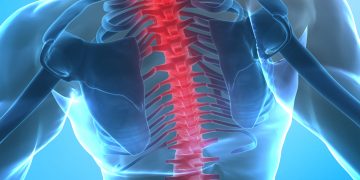 боль в спине