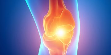 проблемы с коленями