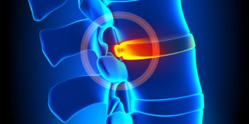 проблемы с позвоночником