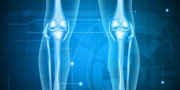 проблемы с ногами