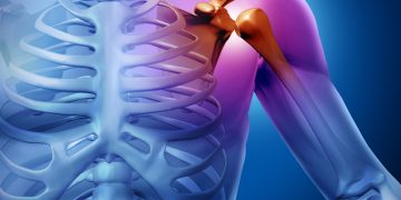 проблемы с плечом