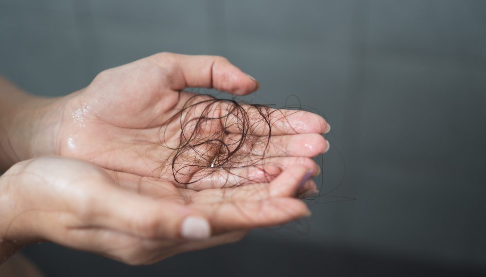 Потеря волос