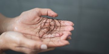 Потеря волос