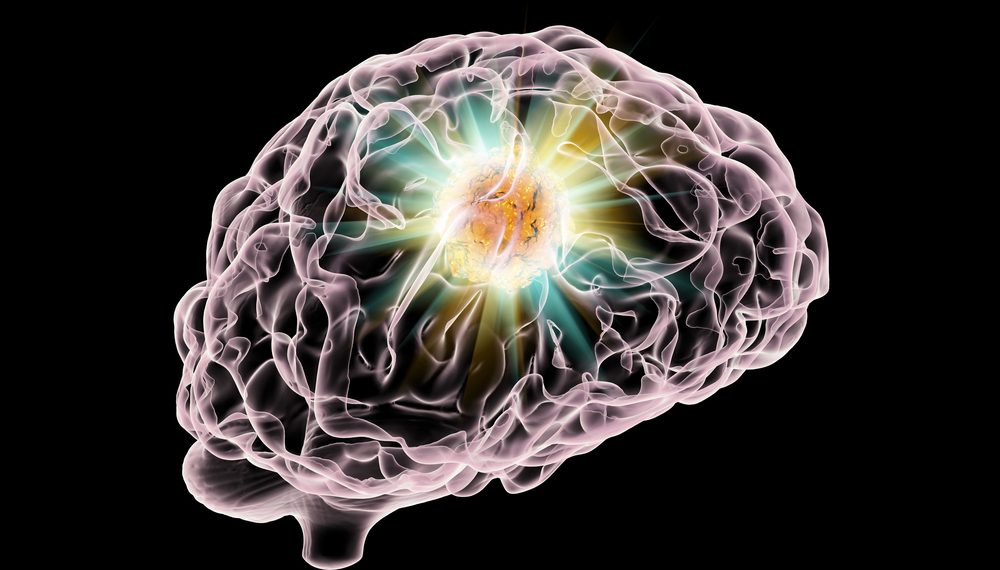 CVA And Stroke Prevention – Oren Zarif