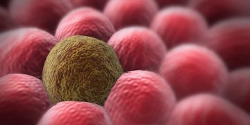 עובדות שלא ידעתם על מחלת הסרטן – אורן זריף