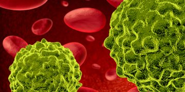 גורמים לסרטן – אורן זריף