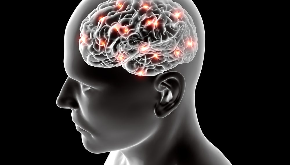CVA And Stroke Prevention – Oren Zarif