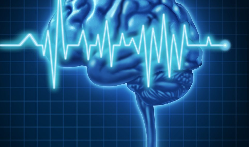 CVA And Stroke Prevention – Oren Zarif